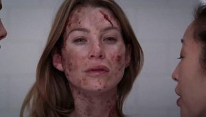 Greys Anatomy 2×17 online sa prevodom